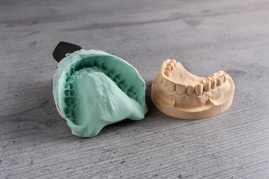 精密な型を採る